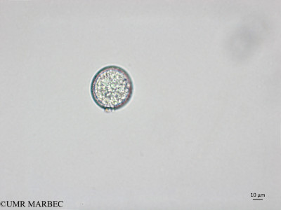 phyto/Brazilian_Nordeste/AtoldasRocas_station22/ABRACOS1 October 2015/Prorocentrum balticum (Snap-2096)(copy)_thumb.jpg